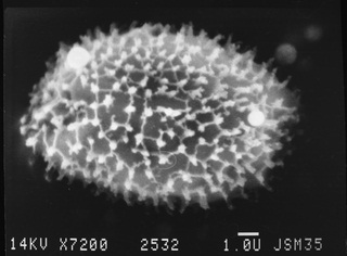 snimak na elektronskom mikroskopu